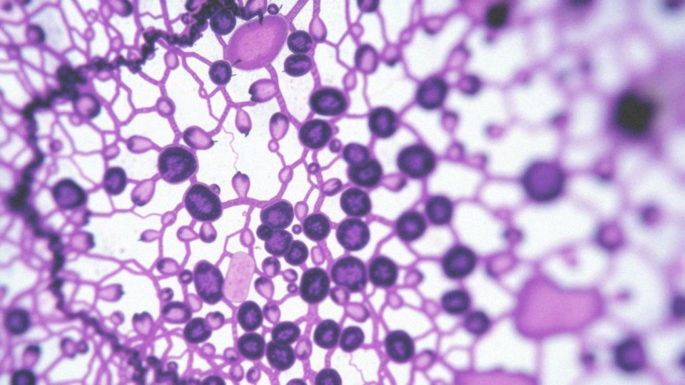 Jak węzły chłonne wspierają układ immunologiczny?
